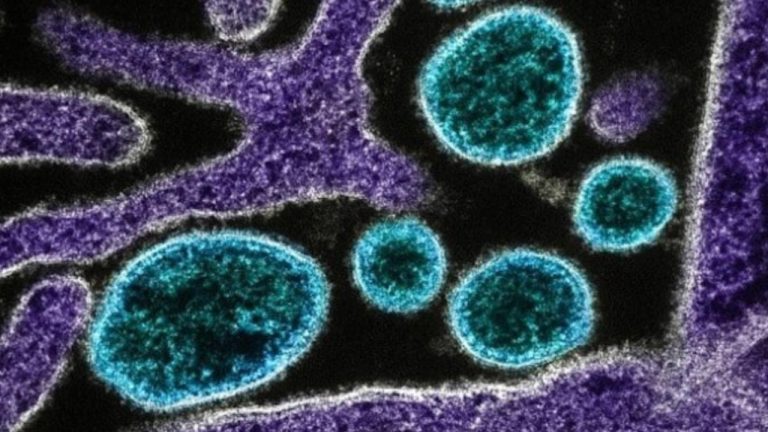 DSÖ, ilk kez bir insanda görülen Shamonda virüsünü araştırıyor